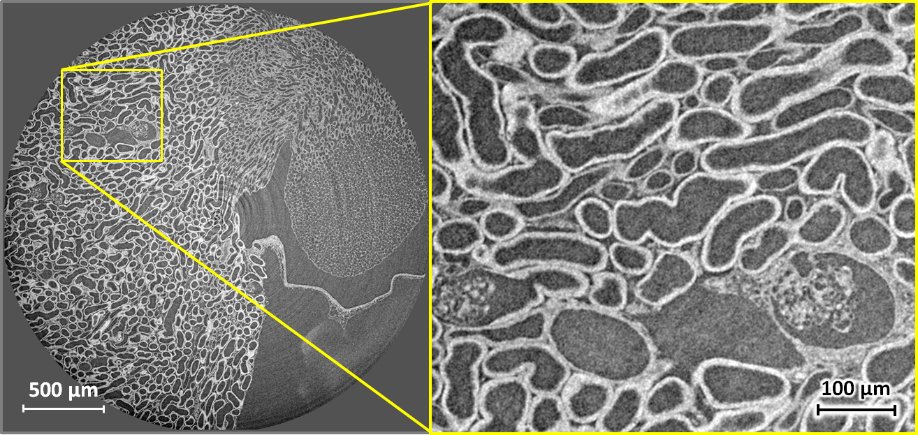 Horizontal X-ray phase-contrast microtomography slice through the kidney of a mouse