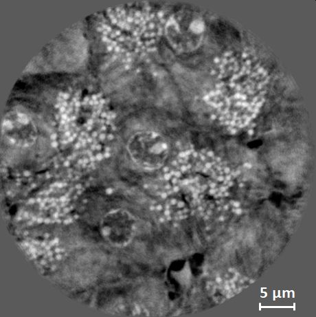 Local TXM nanotomography of mouse pancreas - beamline ANATOMIX