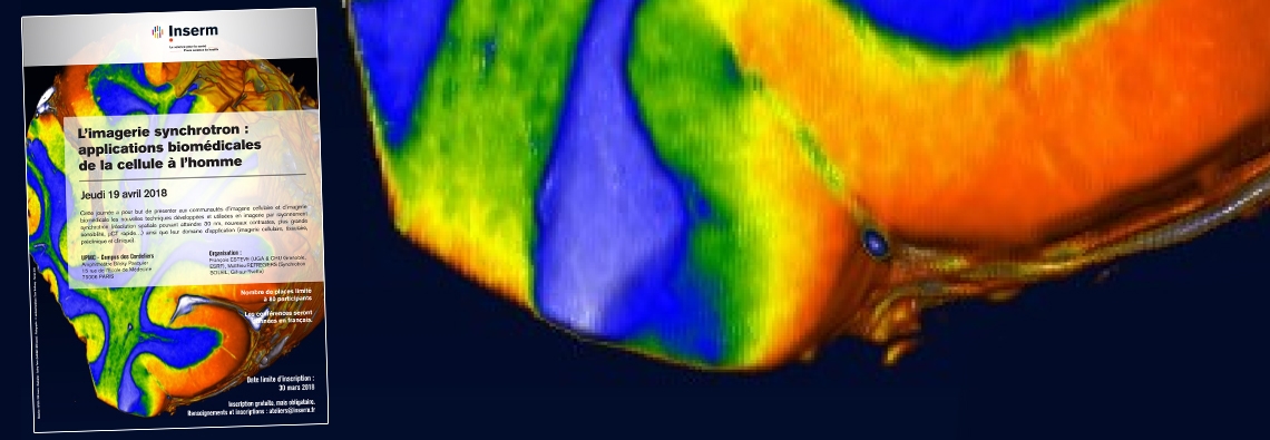 180419-inserm-imagerie-synchrotron-bandeau.jpg