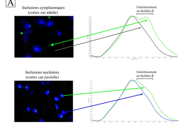 130604-analysestructureproteinea-01.jpg